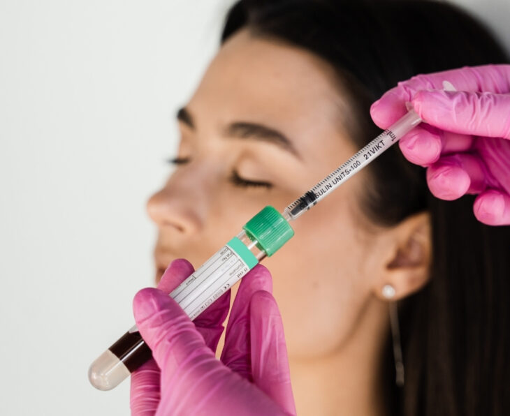 PRP Injections