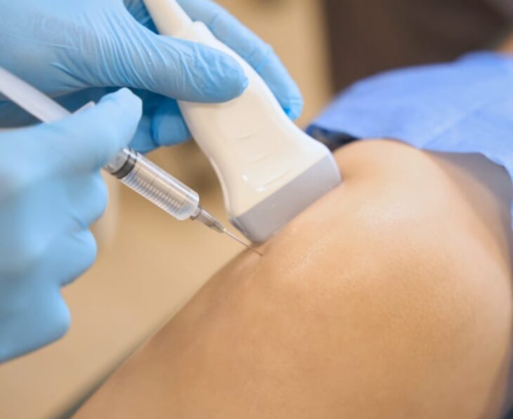 Ultrasound Guided Injections
