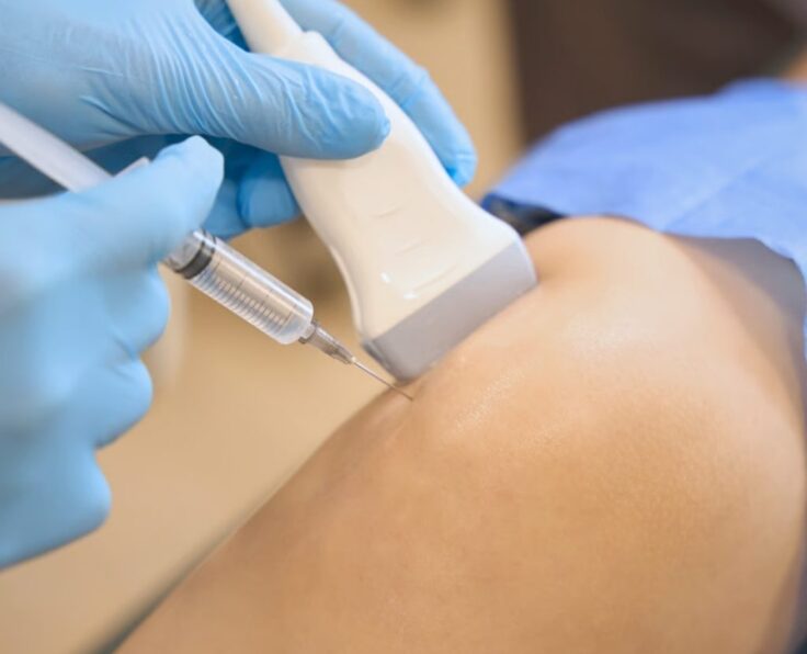 Ultrasound Guided Injections