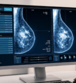 Breast Ultrasound at Pimpama