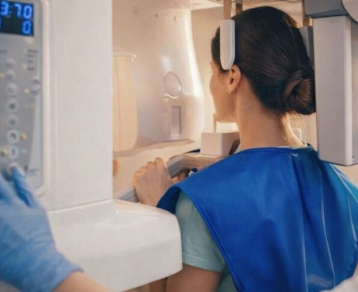CBCT